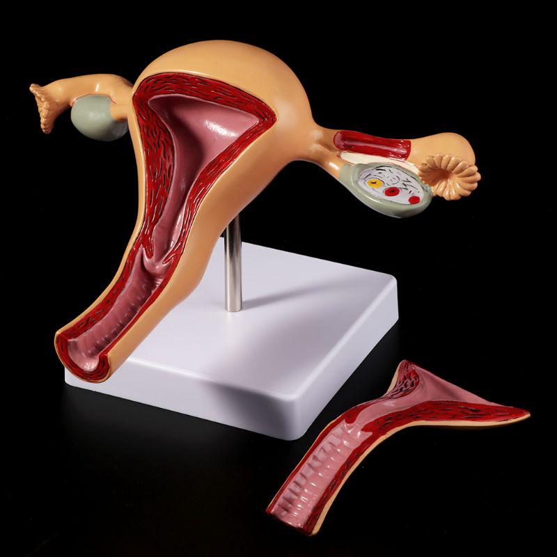 Human Pathological Uterus Ovary Model Anatomical Anatomy Disease Pathology Medical Lesion Teaching