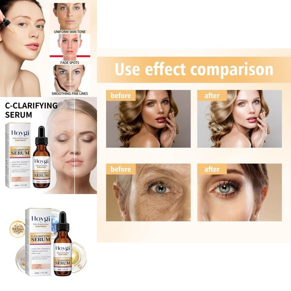 Hoygi Brightening Essence Serum For Hydration And Radiance Enhancing Skin Repair