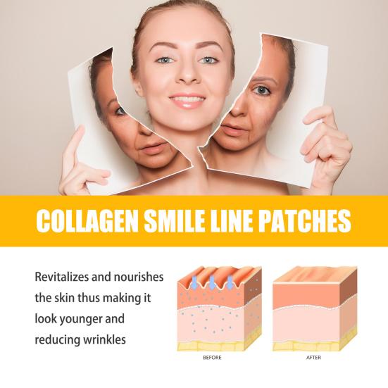 10Pcs/Box Smile Line Patches Non-irritating Effective Firm Skin Reduce Wrinkle Collagen Smile Line Patches for Skin-care