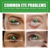Ouhoe Eye Care Essence Reduces Fine Lines Dark Circles Brightens Dull Skin Hydrating Soft Eye Area 30ml