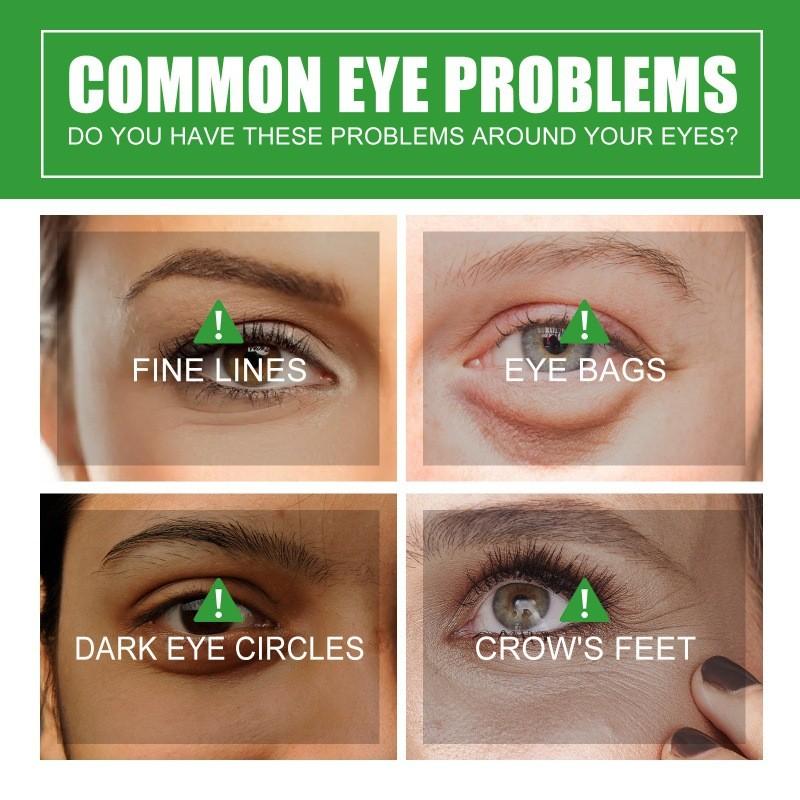 Ouhoe Eye Care Essence Reduces Fine Lines Dark Circles Brightens Dull Skin Hydrating Soft Eye Area 30ml