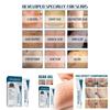 West Month Scar Diminishing Gel For Surgical Scars And Pregnancy Skin Care 20g