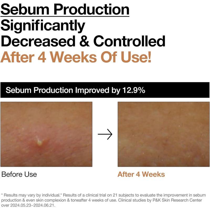 Anua Rice 70 Glow Milky Toner 250ml