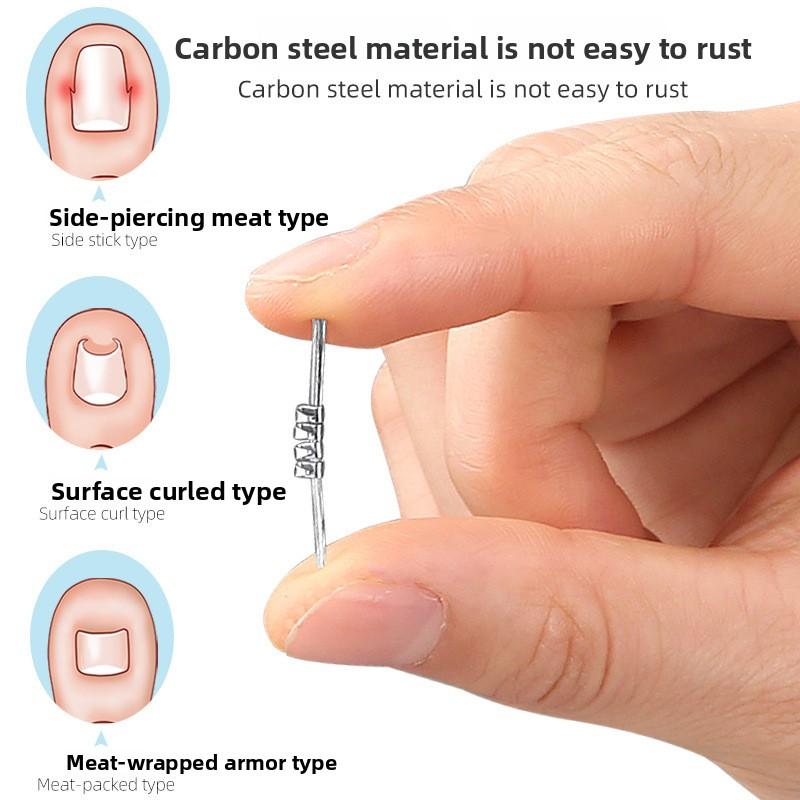 Nowy Pozytywny Klamra na Paznokcie Palec U Stopy Naklejka Ustalająca Rowek Paznokcia Zakręcony Paznokieć Inkrustowany Paznokieć Fizycznie Regulowany Rozciągliwy Demontaż Dostępny dla Mężczyzn i Kobiet