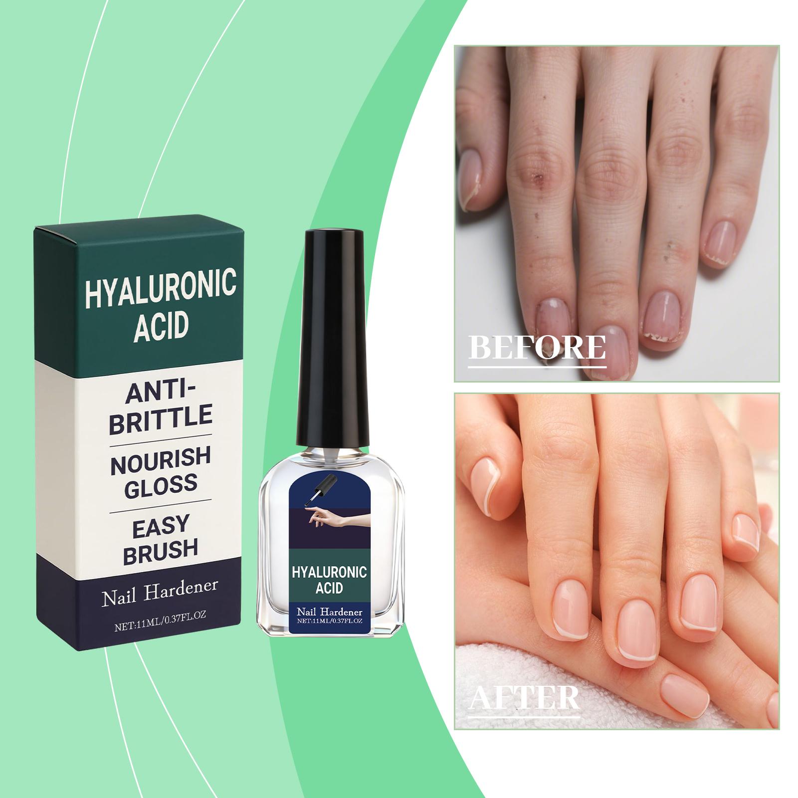 Nail Care Liquid Mildly Nourishes Hands  Feet  Nails  Soft Nails  Thick Nails  Smooth Nails  Liquid 11ml One Size чёрный