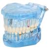 Dental Teeth Model Acrylic Blue Transparent Teaching Demonstration Simulation Teeth Model