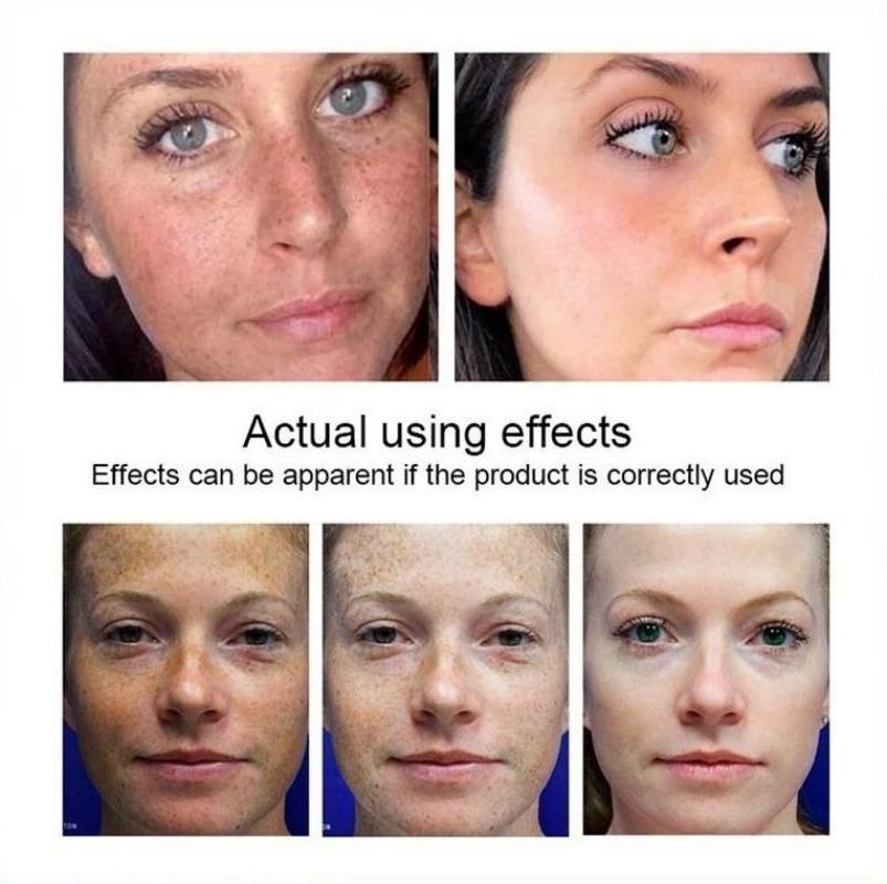 Cea mai nouă cremă de albire pentru față cu vitamina C, care repara pistruii decolorați, îndepărtează petele întunecate Cremă de față pentru înlăturarea melaninei