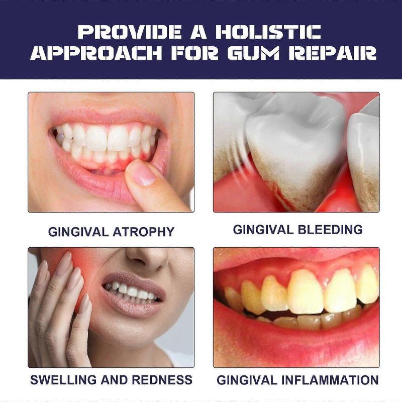Gum Therapy Gel, Teeth Whitening Essence, Gum Instant Treatment, Therapy Gel, Gum Therapy, Gum Repair Pen, Teeth Repair Gel