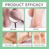 South Moon Foot Ginger Nourishing Spray Gentle Nourishing Heel Soft Refreshing Moisturizing Treatment Spray