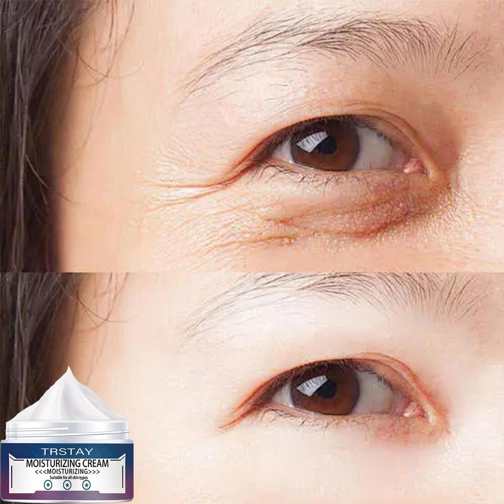 La crema para ojos es suave y no irritante, suaviza las arrugas, reduce las líneas finas, mejora la piel dañada e hidrata la piel.