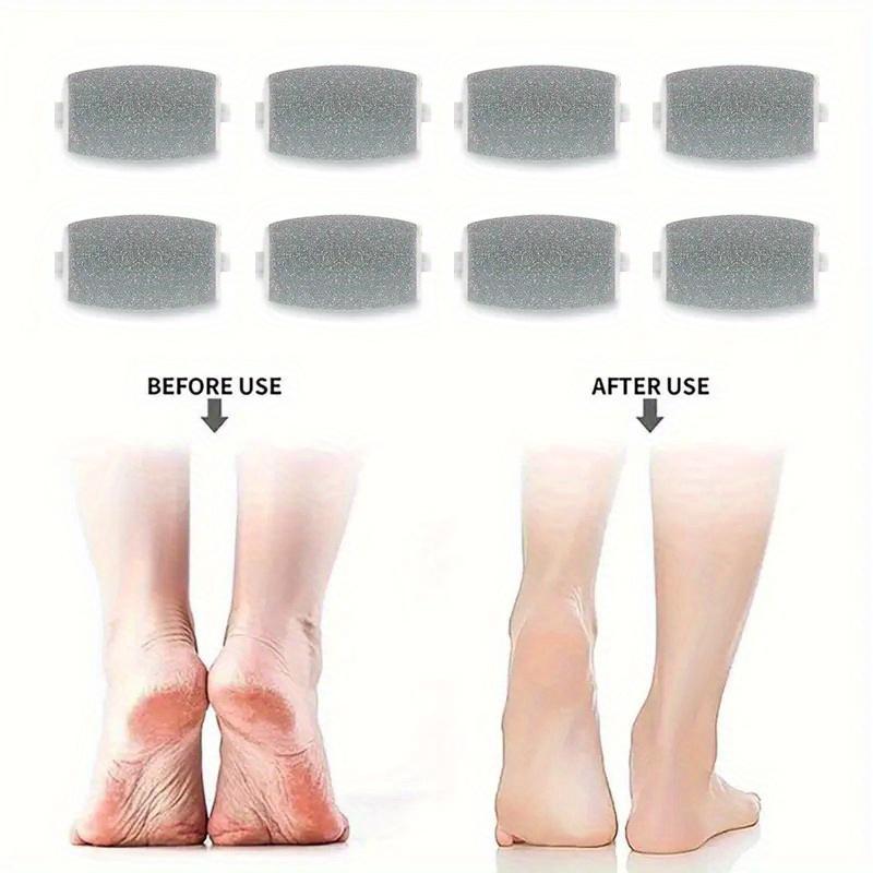 

8-Pack Hypoallergenic Electric Foot File Roller Heads, Pedi Skin Remover Grinding Heads for Leg Pedicure Tools, No Battery Required 8PCS