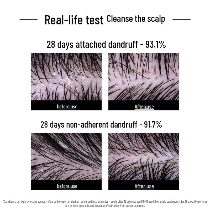 Farma 21 Fluffy Anti-Dandruff Hair Care Set