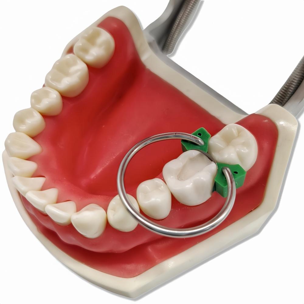 100Pcs/Set Dental Orthodontic Sectional Contoured Matrices Matrix Set Dental Plastic Wedge Rubber Wedges Ortho Matrice Material