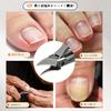 Liangery Premium Angled Nail Stainless for Thick Sharp for Ingrown Foot Nail Extra Large Travel Hand Foot with Storage Case Clippers, Steel, Nails,