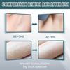 Mustache Hair Removal Cream Moisturizing Fast-acting Painless Facial Mustache Remove
