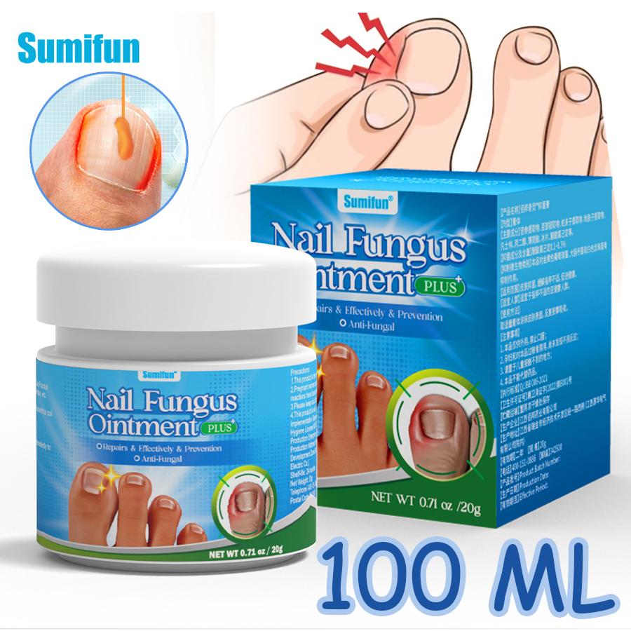 Sumifun 20/40/100 ML Toenail Correction Repair Ointment Relieve Nail Fungus Infected Brightening Soft Nails Health Nourish Moisturize Cream