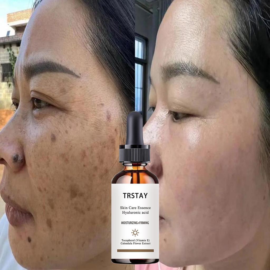 Dark Spot Corrector Cream, Ingredient, Enriching Skin Care For All Skin Tones, Melasma, Freckle, Sun Spot Improving For Women And Men