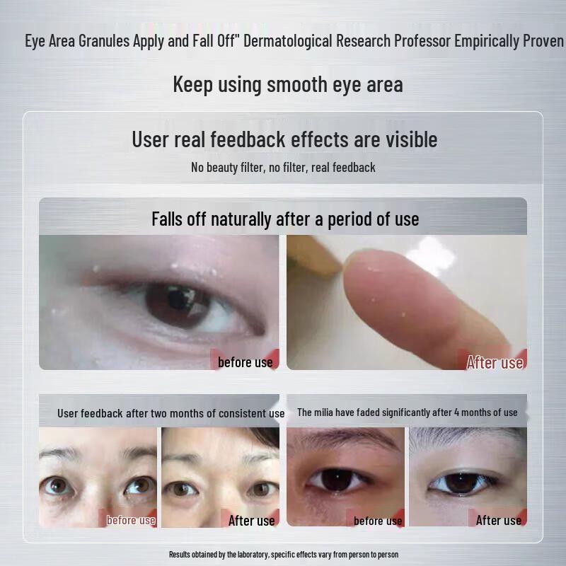 Tong Ren Tang Milia & Eye Bag Eye Serum, 30ml