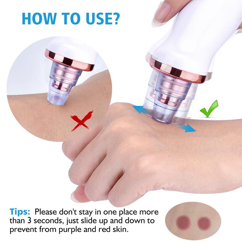 Electric Blackhead Remover Vacuum Pore Cleaner Nose Face Deep Cleaning Blackhead Remover Face Clean Pore Vacuum
