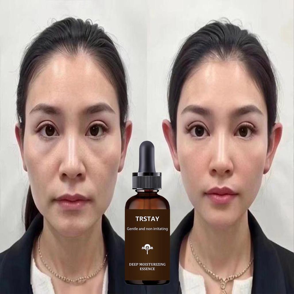 TRSTAY Anti Wrinkle Face Cream Facial Essence Peptide Wrinkle Remover Anti Aging Essence Lifting, Tightening And Weakening Fine Lines Facial Essence