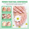 Nail Growth Serum  Nail Polishing Strengthening Nourishing Nail Serum 60ml