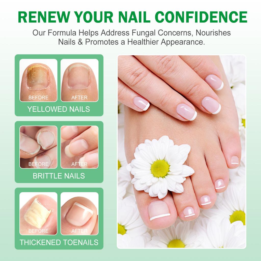 Nail Growth Serum  Nail Polishing Strengthening Nourishing Nail Serum 60ml