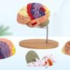 Modelo de Anatomía Cerebral Muestra el Tronco Encefálico y Otras Partes del Cerebro Humano