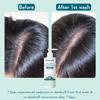 WishCare Hydrating AHA BHA Anti Dandruff Shampoo 250ml For Women Men, Scalp Care, Flake Control