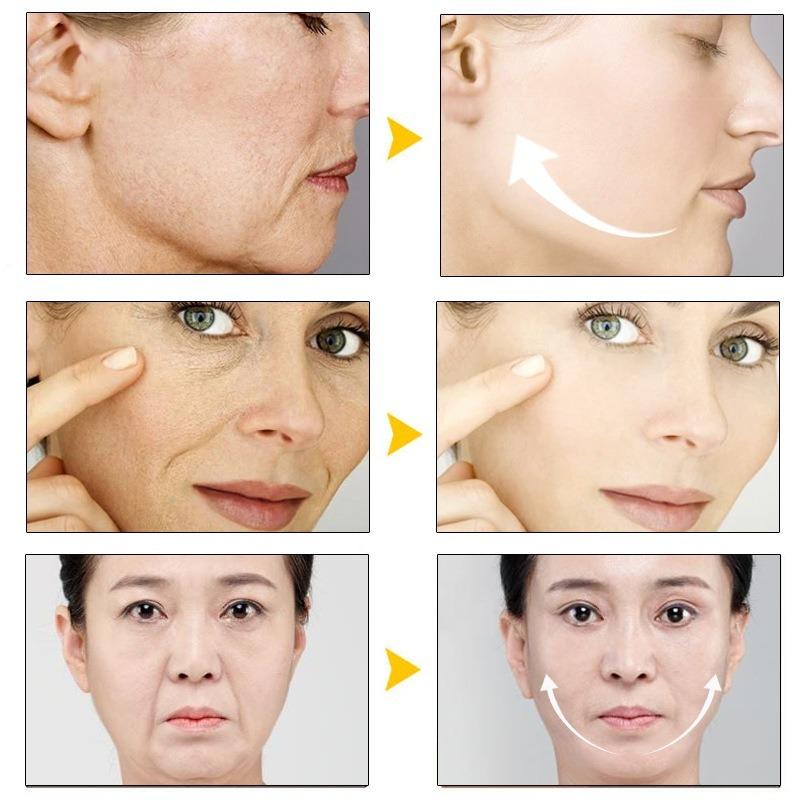 The New Generation of Cell Energy Cream, the Ultimate Whitening Fleck Skin Cream -360 Degrees To Restore the Skin