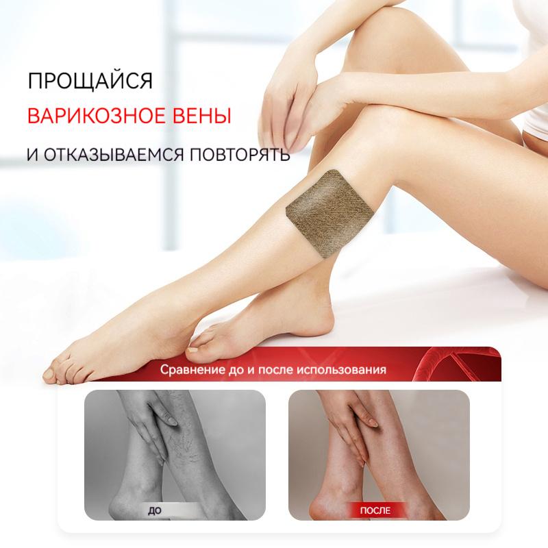Varicose Veins Ease Plaster Chinese Herbal Patch For Veins To Enhance Capillary Health Care