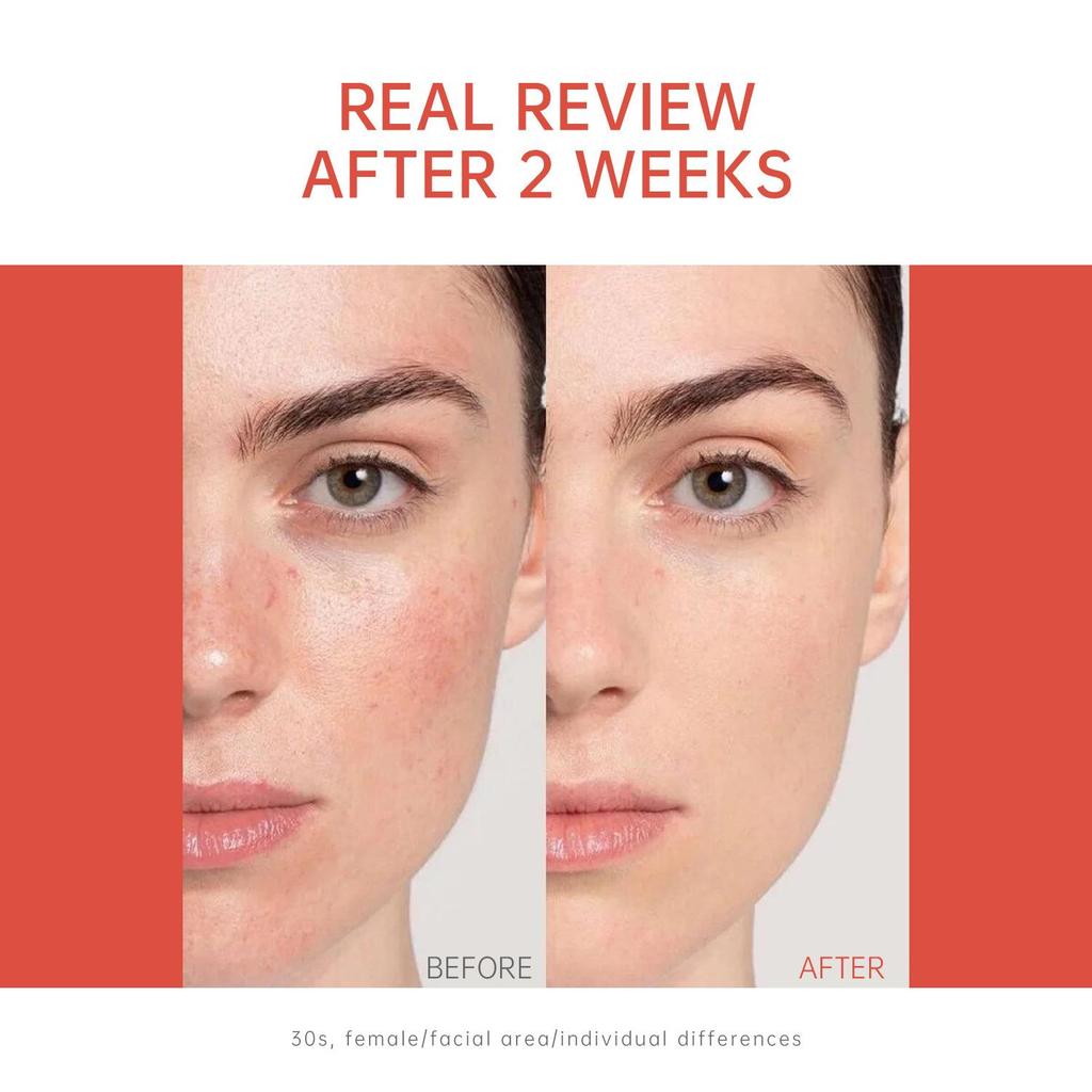 Salmon ampoule essence, anti-wrinkle, lighten fine lines, strengthen skin essence