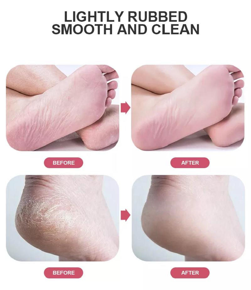 Lima per Piedi in Vetro Nano Cristallo Rimuovi Calli Rasoio Rimuovi Pelle Morta Dura Spaccata Secca Strumento Professionale per Talloni e Piedi Raspa Pedicure