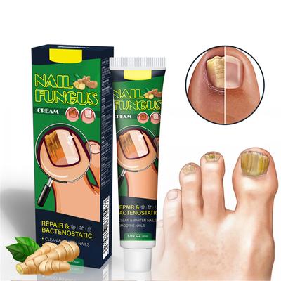 Gel per unghie, unghie per ripristinare l'aspetto di unghie scolorite o danneggiate
