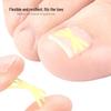 Star-Shaped Ingrown Toenail Correction Patch