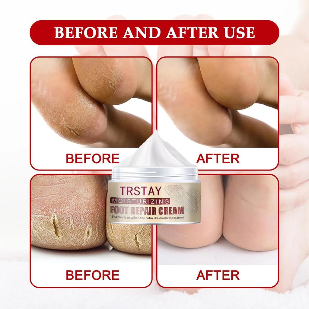 Nourishing Hand And Foot Mask Set With Moisturizing Foot Cream, For Smooth And Glowing Skin