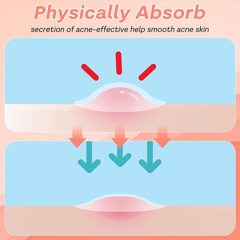 360 Unidades Parche para Ampollas Bucales Parche para Calenturas Labiales Parche para Ampollas Labiales Curación de Calenturas Hidrocoloide Pegatinas para el Cuidado de los Labios Parche para Ampollas Bucales