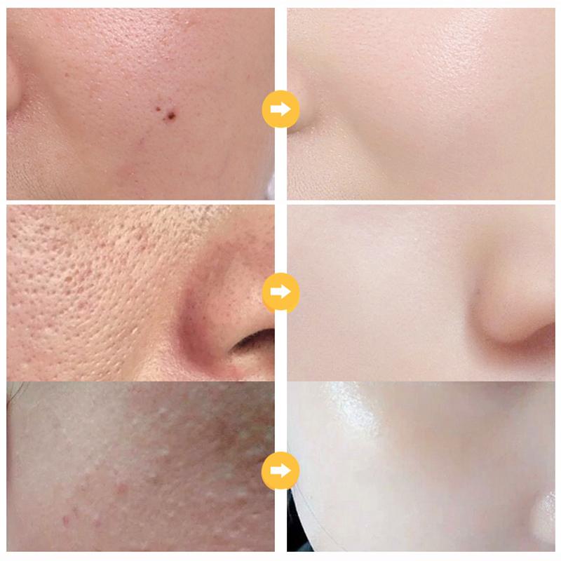 24K Gold Hyaluronic Acid Serum Oil Control Smoothing Rejuvenating Brightening Facial Serum