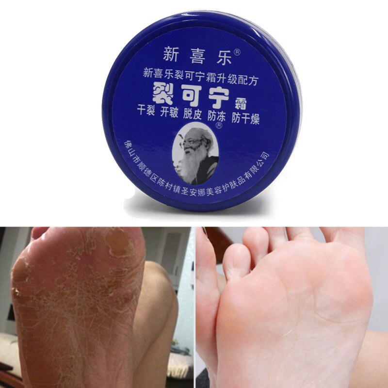 Fußcreme gegen gefrorene Risse, feuchtigkeitsspendendes Peeling, entfernt Schwielen, verhindert das Austrocknen der Ferse, Handcreme