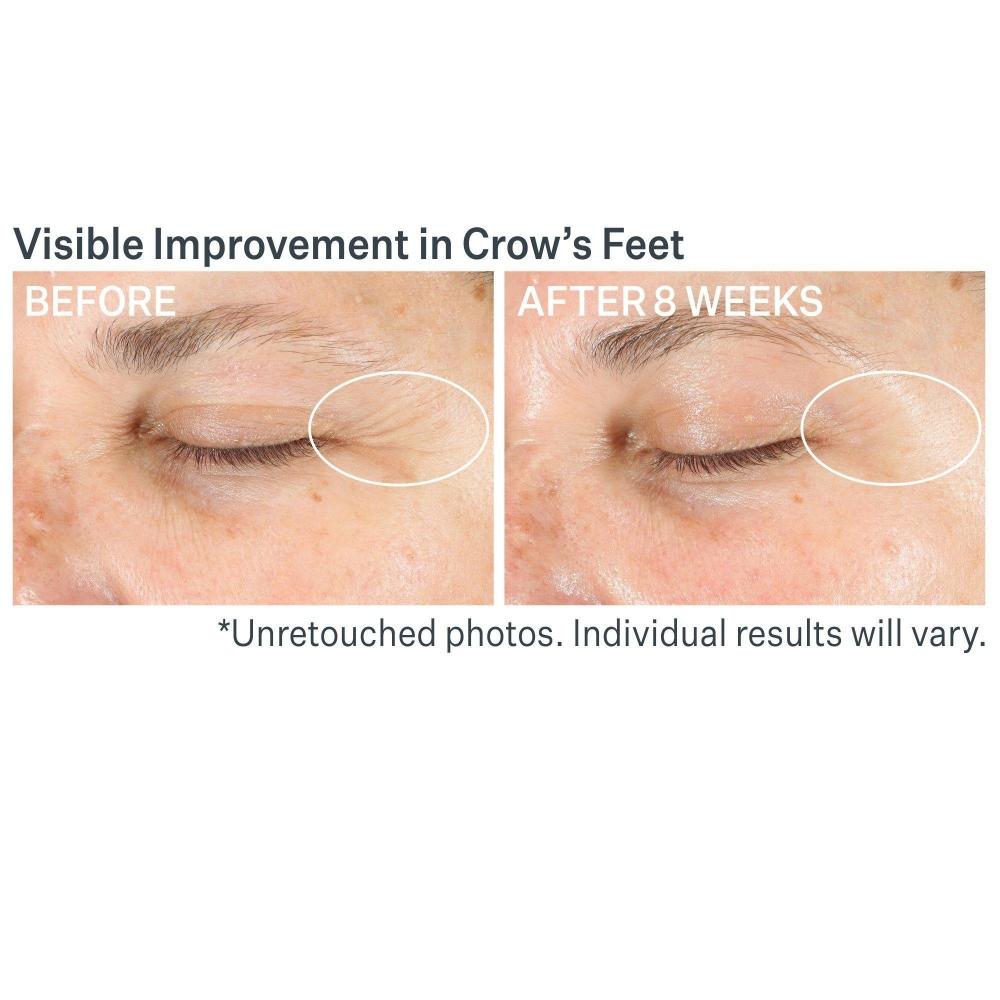 Strivectin Advanced Retinol Multi Correct Eye Cream 0.5 Oz