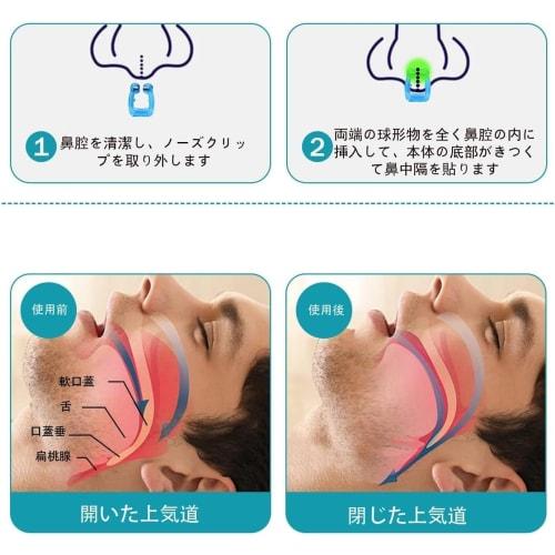 Coolboy [Featured in anan x Supervised by Sleep Professionals] Anti-Snoring Nose Clips, Anti-Snoring Device, Anti-Snoring Aid, Nostril Dilation, Promo