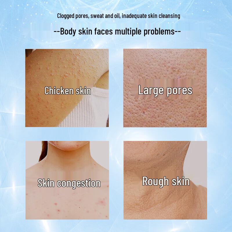 STRIDEX Salicylsäure Körper-Pads