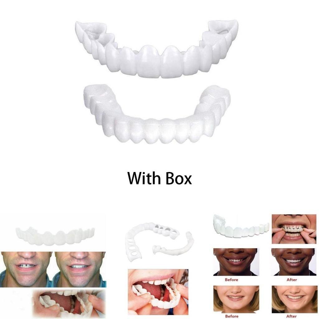 Lower Upper Teeth Dental Veneers Denture Tooth Cover Simulati Set