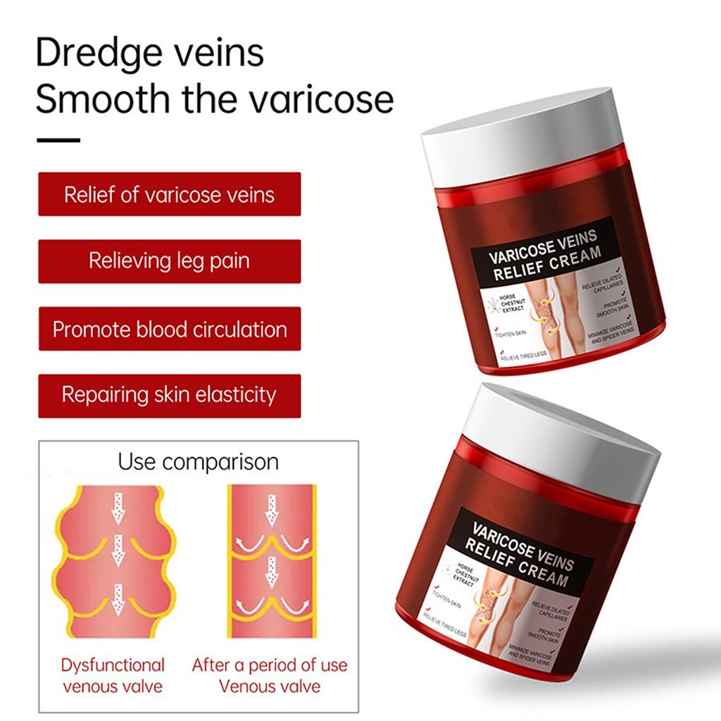 Varicose Vein Relief Paste Improve Blood Circulations Spider Varicose Vein  For Tired Heavy Legs Fast Relief New
