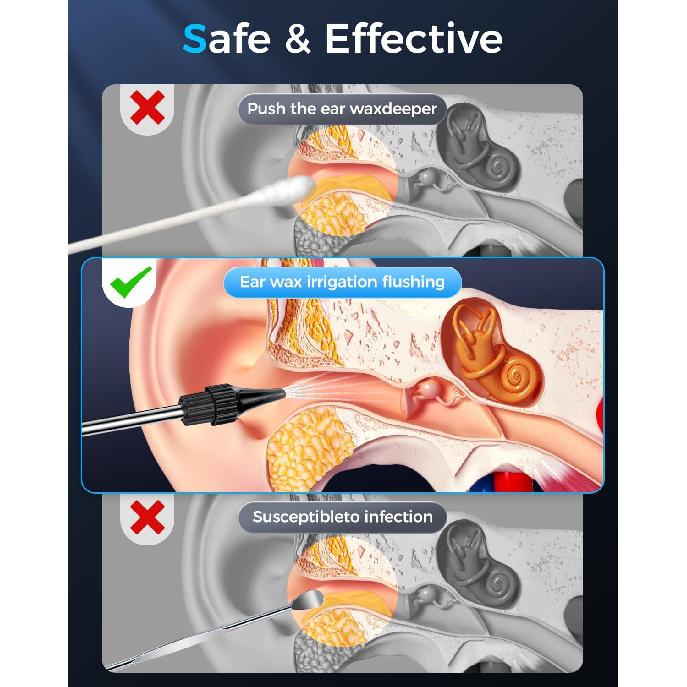 Ohrreiniger für Erwachsene – Elektrischer Ohrreiniger mit 4 Druckmodi & 10 wiederverwendbaren Aufsätzen, Sichere & wasserfeste Ohrspülung, USB-aufladbar
