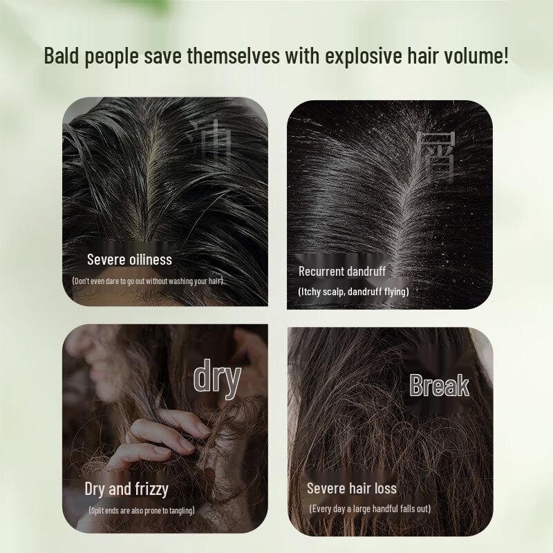 Herbal Anti-Breakage & Oil Control Shampoo Bar