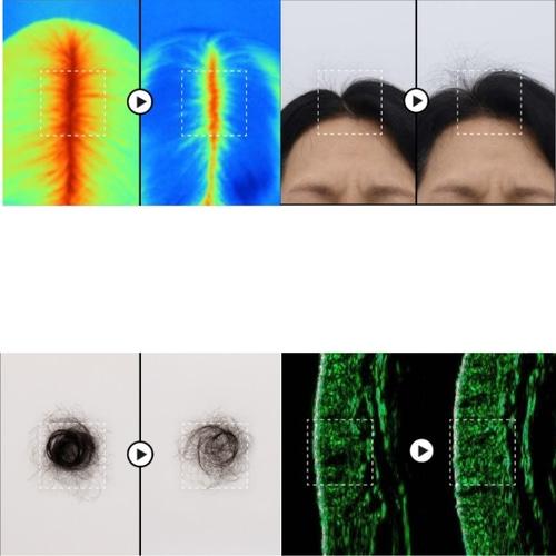 HAUM PGGM Anti-Hair Loss Scalp Therapy Shampoo 400ml