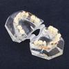 Dental Orthodontic Treatment Malocclusion Study Teeth Model With Wire Chain