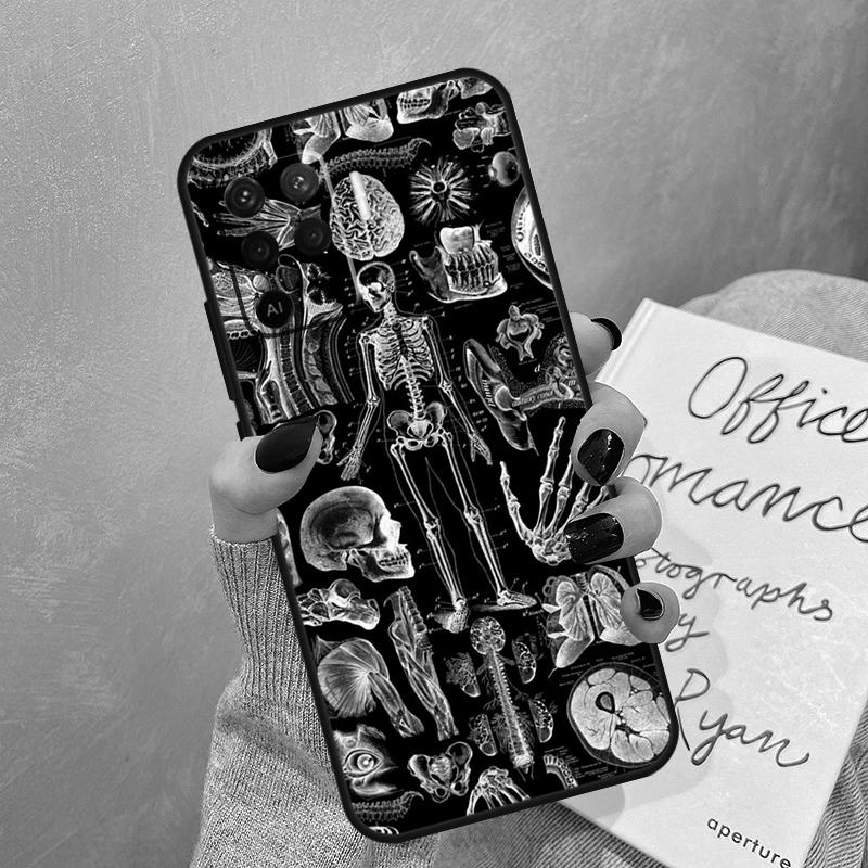 X-Ray Human Anatomy Case For Oppo A40 A60 A80 A78 A38 A18 A98 A58 A96 A76 A16 A94 A74 A54 A15 A17 A57 A77 A5 Pro