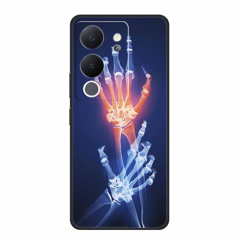 6.67" For Vivo V30 Lite Case Black Silicone Soft Phone Cases For Vivo V30 Lite Back Cover Case V 30 Lite Funda Coque Shell Capas