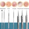 3-8pcs Acne Needle Remove Blackhead Comedone Extractor Tools Stainless Steel Facial Skin Care Tool Pimple Blemish Removal Tools
